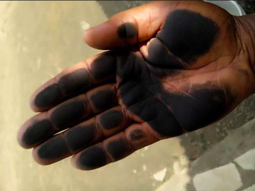 A Port Harcourt resident rubs his hand on the soot and black carbon