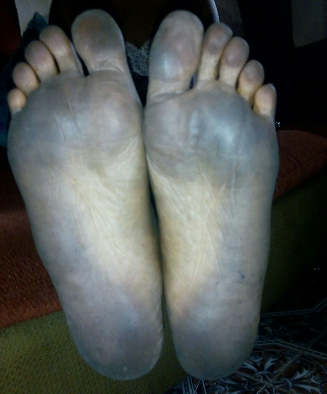 A Port Harcourt resident  who stepped on the soot 