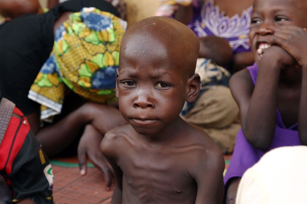 The face of a hunger-ravaged child in Bornu, North-East Nigeria